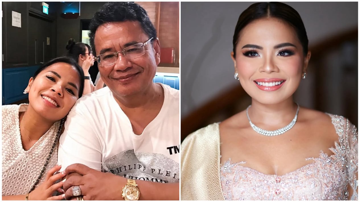 Hotman Paris Tetapkan Syarat Nikah Felicia: Pisah Harta